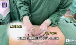 爆料桂哥抽脂视频教程全集,轻松掌握塑形技巧